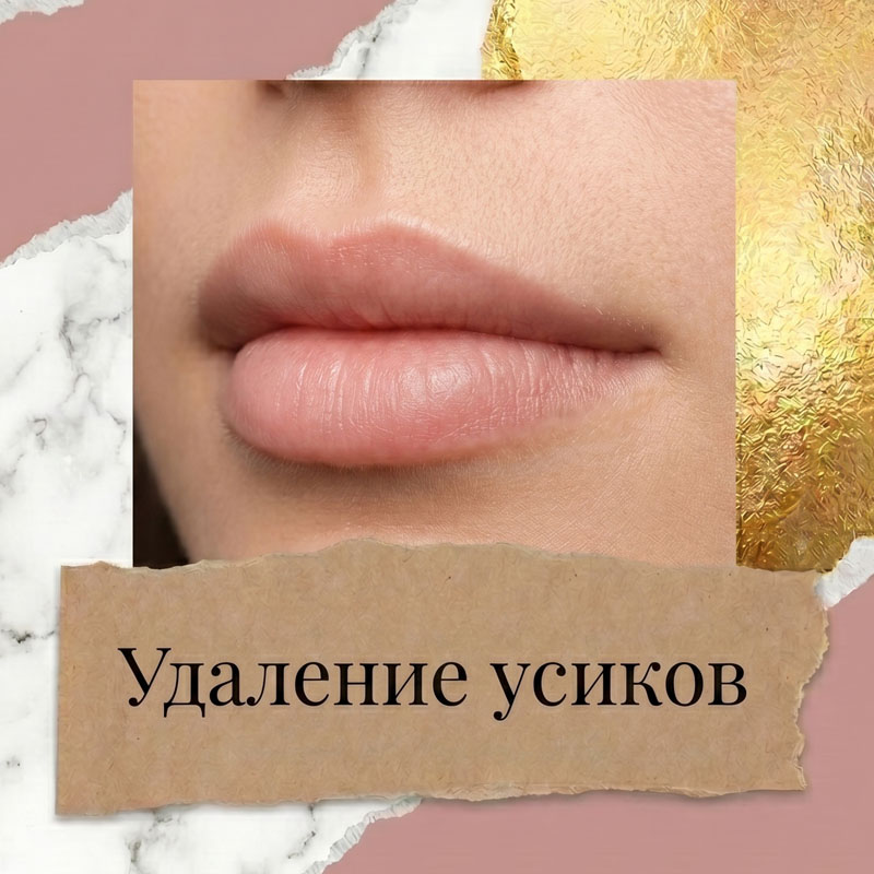 Удаление усиков